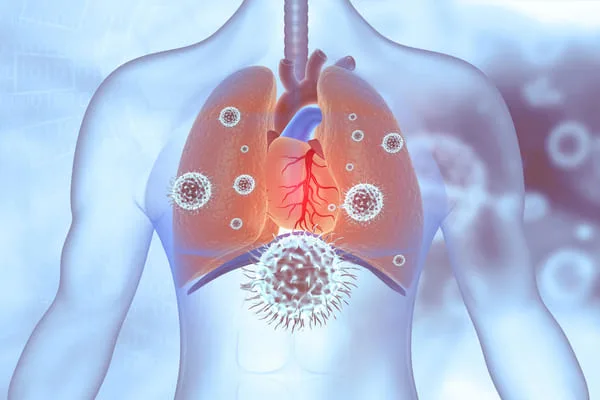 Не чекати, поки вірус опуститься у бронхи: важливо при ГРВІ